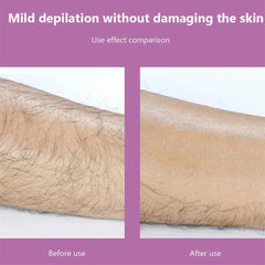 Reuseable Painless Crystal Hair Remover