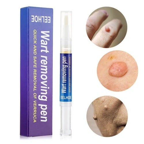 Warts & Moles Remover Pen (14 Days Money Back Guarantee)