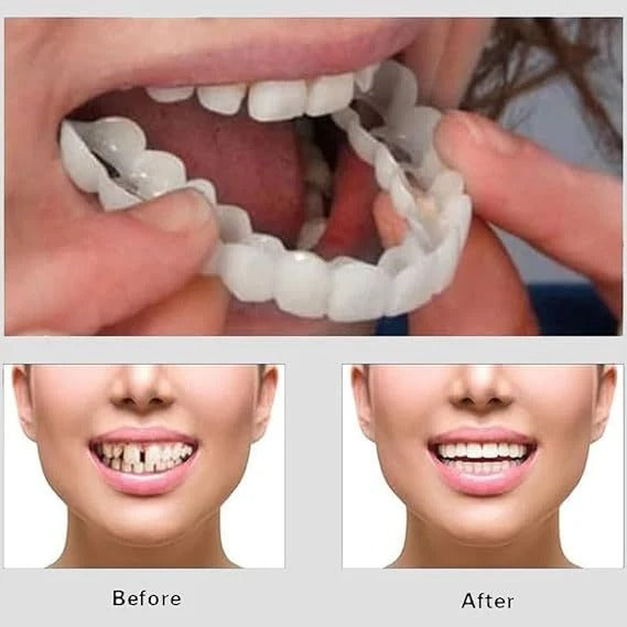 Silicone Imitation Braces Teeth Decoration Kits