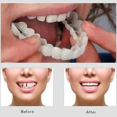 Silicone Imitation Braces Teeth Decoration Kits